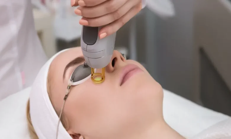 Achieving Radiant Complexion with Clear Skin Laser Treatments
